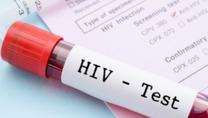 AIDS değil bilinçsizlik öldürüyor