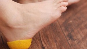 Bağışıklık sisteminizi limon sürerek güçlendirebileceğinizl biliyor muydunuz?