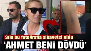 Sıla: Ahmet Kural beni dövdü