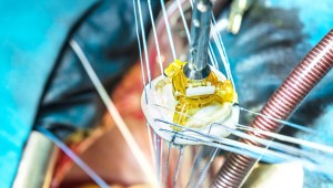 Tıp dünyasında devrim artık Türkiye'de üretilecek