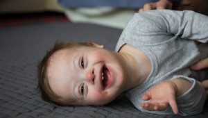 +1 fark, hayata engel değil! Down Sendromu hastalık değil, genetik farklılık