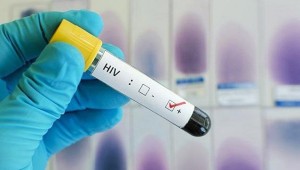 Kök Hücre Tedavisi Sonrası HIV Virüslü Hastada İyileşme Tespit Edildi