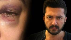 Bakırköy'de dehşeti yaşayan kadın: Korkudan 1 aydır evden çıkamıyorum