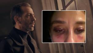 Eski sevgilisi, Rubato grubunun solisti Özer Arkun'dan şiddet iddiasıyla şikayetçi oldu