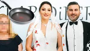  Erkan Başboğa 1.5 aylık eşi Zeynep Melis Başboğa ile teflon tavanın çizilmesi yüzünden tartıştı.