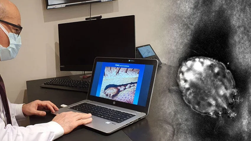 Koronadan sonra uyuz salgını! 