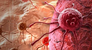 Kanser ve beslenme ilişkisi üzerine düşünceler